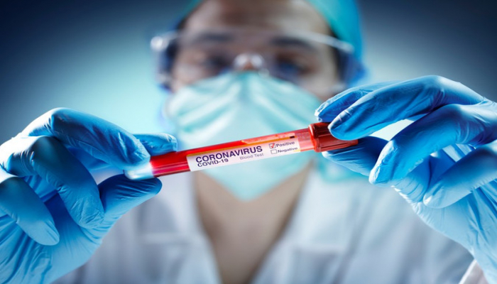 Azərbaycanda daha 101 nəfərdə koronavirus aşkarlandı, 53 nəfər sağaldı