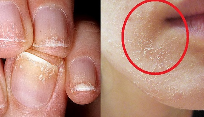 Dodaq kənarlarında çatlar, toyuq korluğu, quru dəri... - Sizdə bu vitamin çatışmır