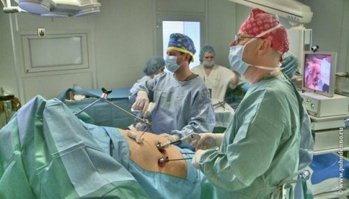 Медики рассказали о риске восстановления веса после бариатрической операции