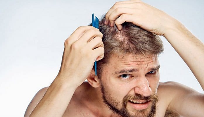 Kəpəyin yaranma səbəbləri və müalicəsi