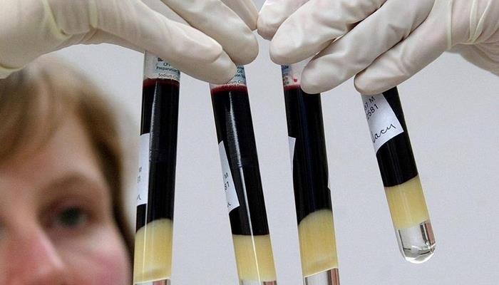 Diqqət: Yeni ölümcül infeksiya yayılır