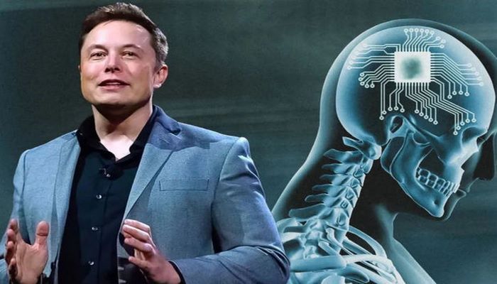 Dünyada bir ilk: İnsan beyninə çip yerləşdirildi