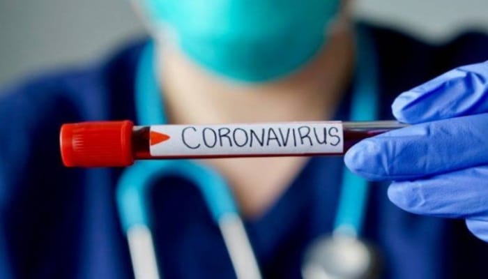 В Армении 235 случаев заражения коронавирусом