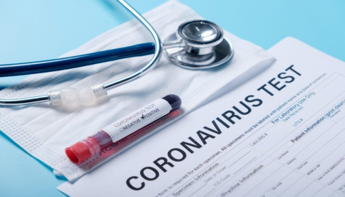 Azərbaycanda daha 113 nəfər koronavirusa yoluxub, 40 nəfər sağalıb