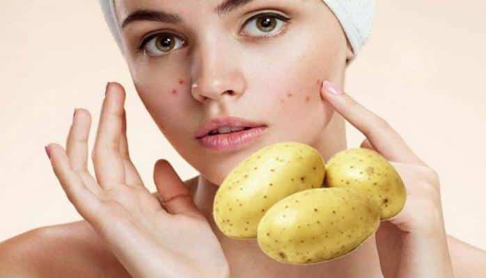 “Şeytanın qidası” adlandırılan tərəvəz haqqında bilmədikləriniz – Zərəri və faydaları