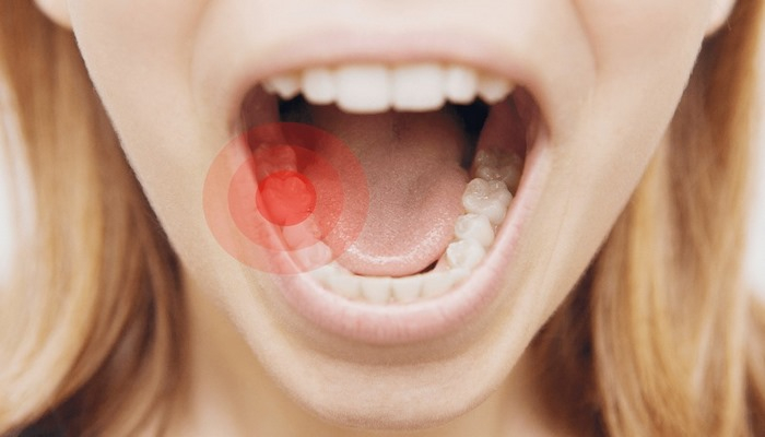 Abses nədir? – Bütün orqanlara zərər verir