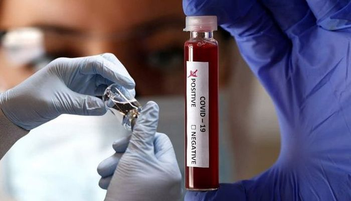 D vitamini koronavirusdan ölüm nisbətini azaldır