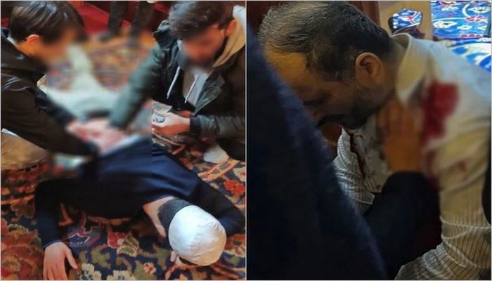 Ərdoğan məscidin bıçaqlı hücuma məruz qalan imamına zəng edib