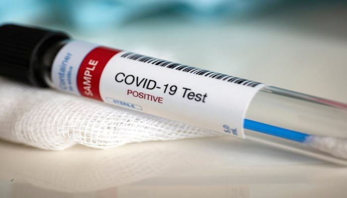 Çində koronavirusa yeni yoluxma halları qeydə alınıb