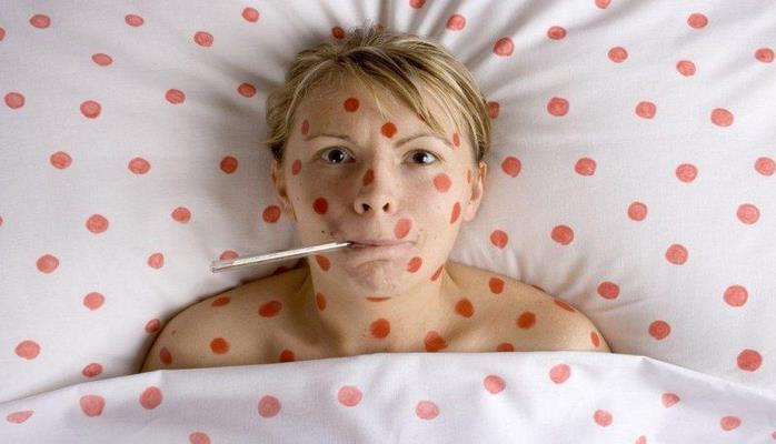 Evdə uşaqlardan valideynə keçən 5 xəstəlik - Böyüklər daha ağır keçirir