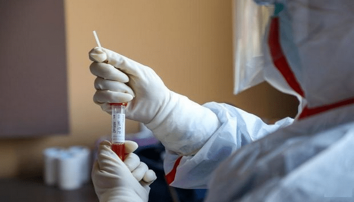 Rusiyada koronavirusu 15-20 dəqiqəyə müəyyən edən sistem təqdim edildi
