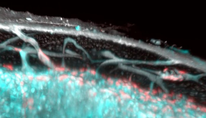 İnsan sümüklərində elmə əvvəllər məlum olmayan qan damarları tapılıb