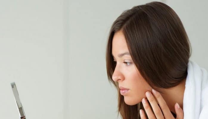 Bu qida üzdəki sızanaqları kökündən qurudur