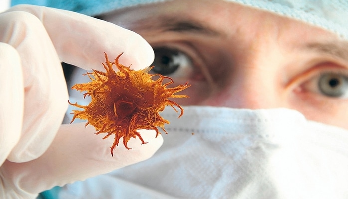 Xərçəng xəstəliyi dünyanın bütün regionlarında vaxtsız ölümün əsas səbəbi olaraq qalmaqdadır