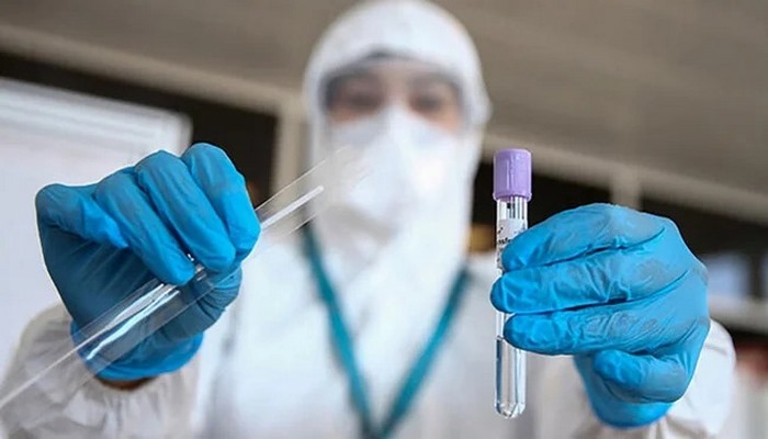 Korona virüsü testi fiyatları dudak uçuklatıyor