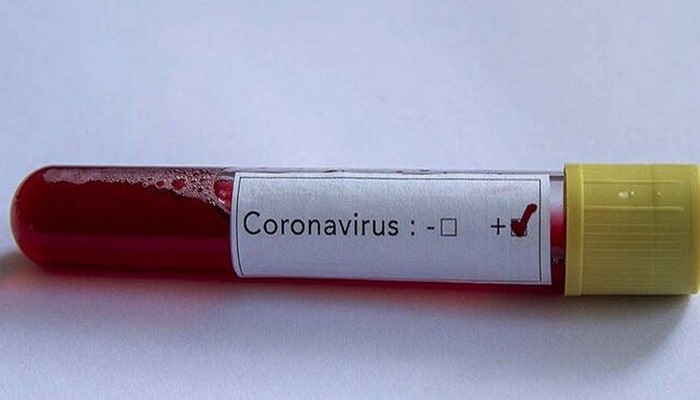 Koronavirüsle ilgili korkutan gelişme! İkinci kez yakalanınca ortaya çıktı