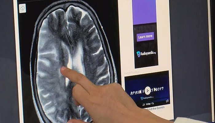 Koronavirüsü belirtisiz geçirenler için büyük risk: Eylül ve Ekim aylarına dikkat!