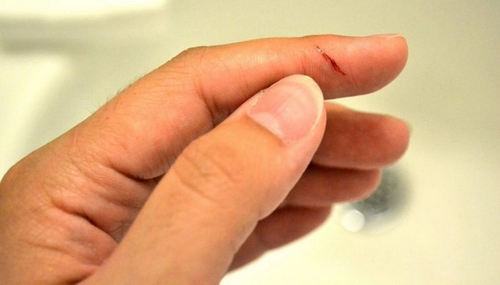 Niyə təsadüfən barmağımızı  kağızla kəsirik