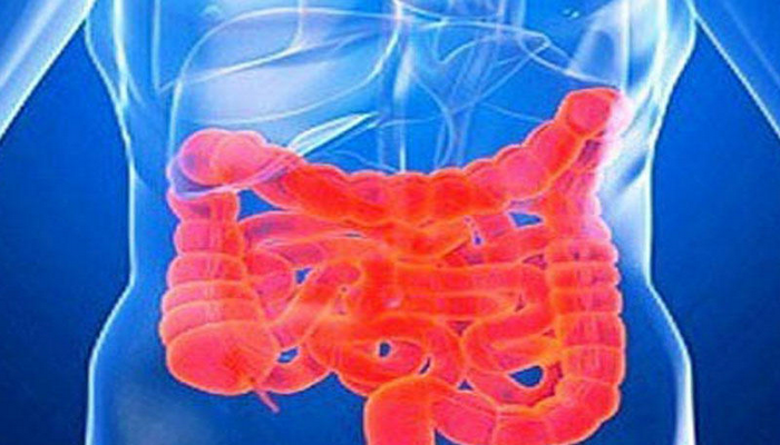 Qeyri spesifik yaralı kolit