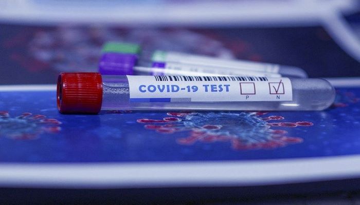 С завтрашнего дня в Турции будут применяться серьезные меры в связи с коронавирусом
