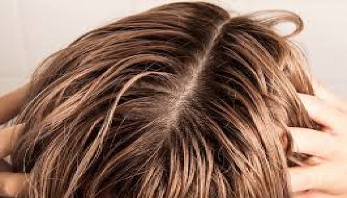 Saçlarda yağlanmanın səbəbləri: Təbii yollarla aradan qaldırmaq olarmı?