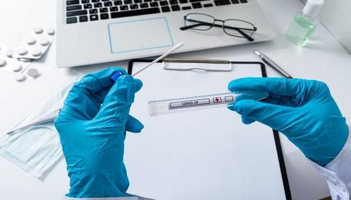 TƏBİB gündəlik test sayının az olmasının səbəbini açıqladı