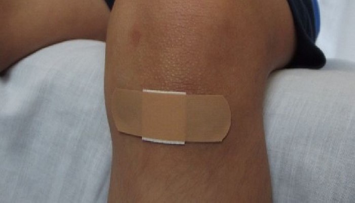 Ученые: скорость заживления ран зависит от генетики