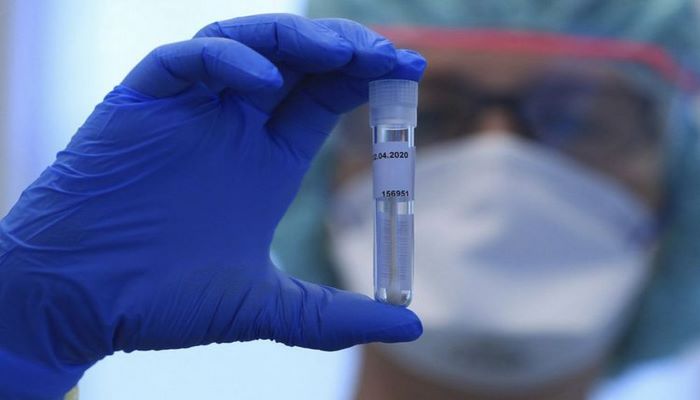 В США за последние сутки от коронавируса умерли 476 человек